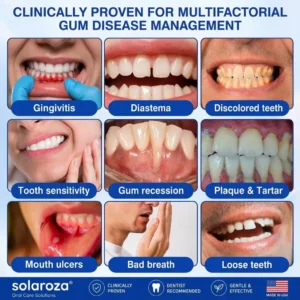 🏅🦷🛡️  Solaroza®  GumRevive Advanced Gum Care & Repair Gel🌞
