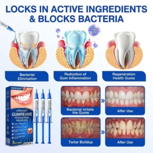 🏅🦷🛡️  Solaroza®  GumRevive Advanced Gum Care & Repair Gel🌞